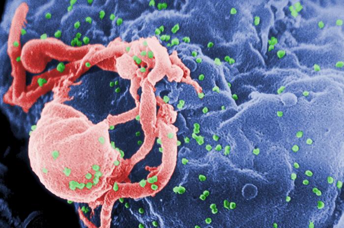 HIV : Britain Scientists on Brink of HIV Cure