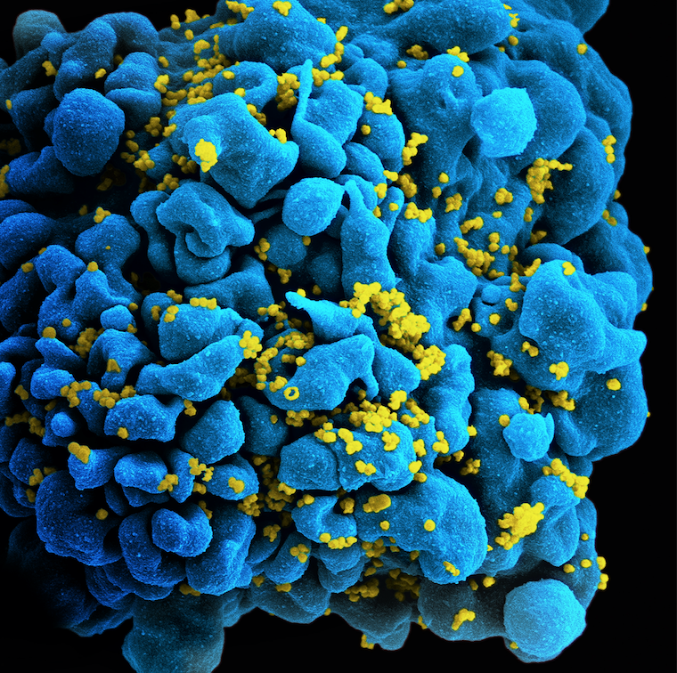 HIV: New Zealand HIV Rates Reach Record High