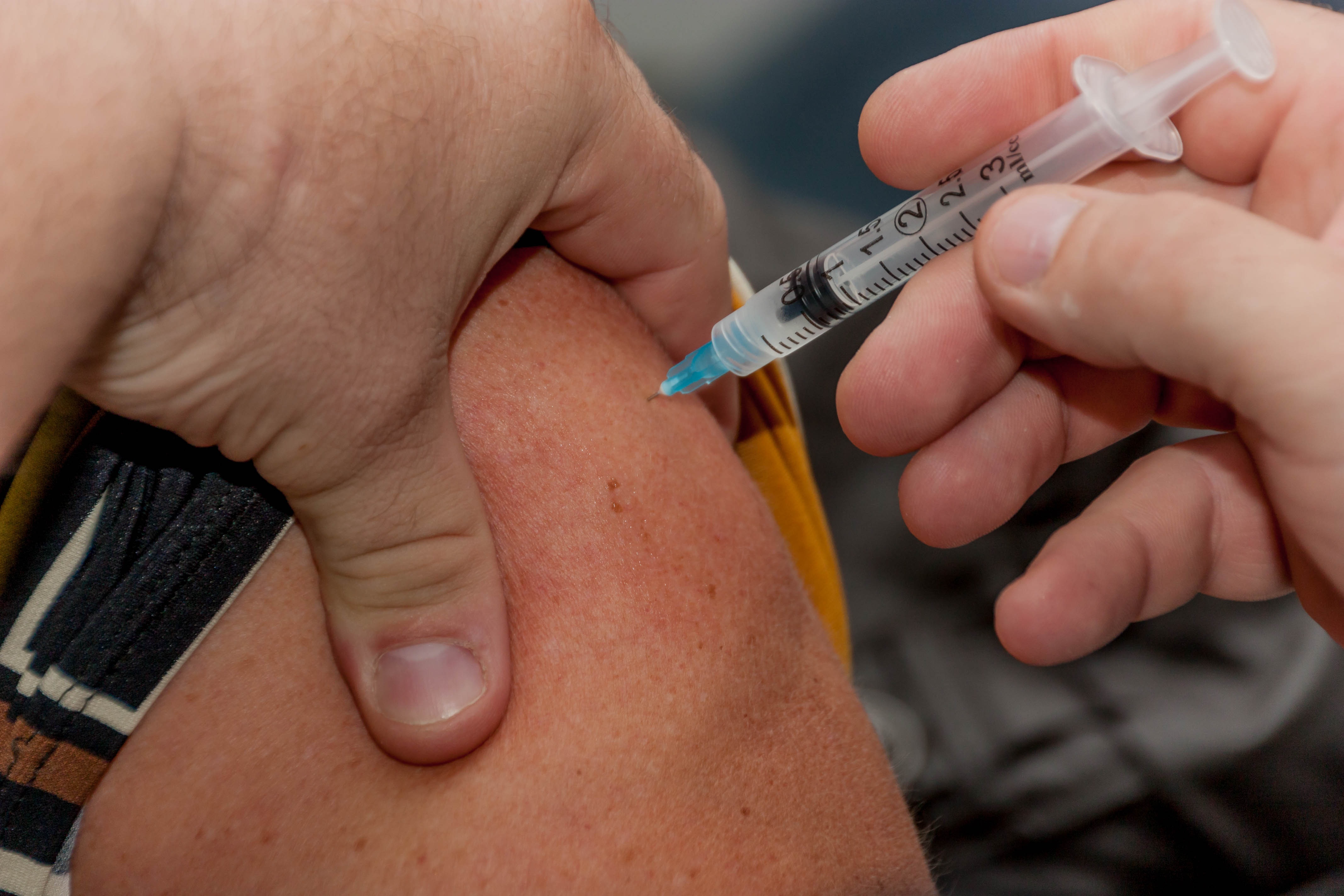 Health : Health Officials Warned Public of Mumps Outbreak in LA