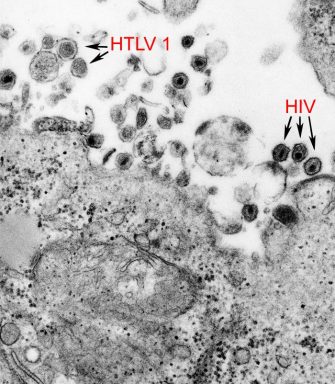 Health: What is HTLV-1?