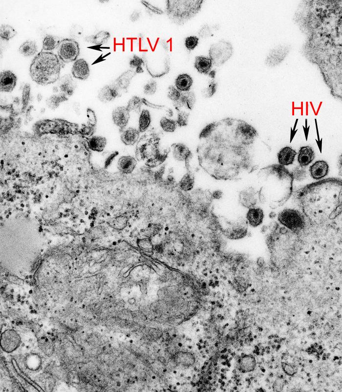 HTLV-1_and_HIV-1_EM_8241_lores